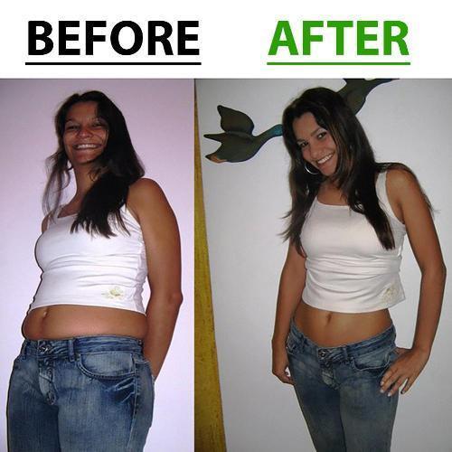 Belly Slimming Patch Set