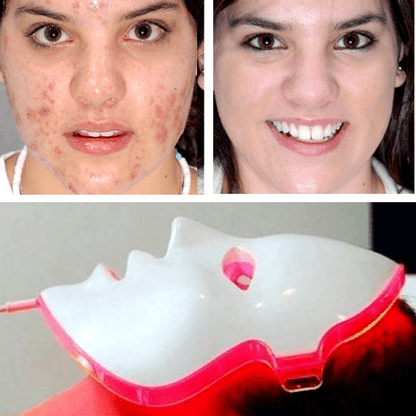 LED Light Therapy Facial Mask
