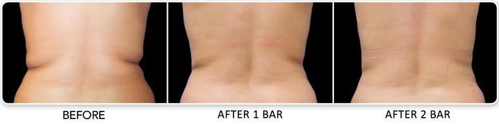 The Original Volcanic Clay Coffee Slimming Soap Bar