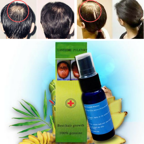 #1 Hair Growth Treatment Spray