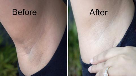 #1 Underarm Whitening Cream