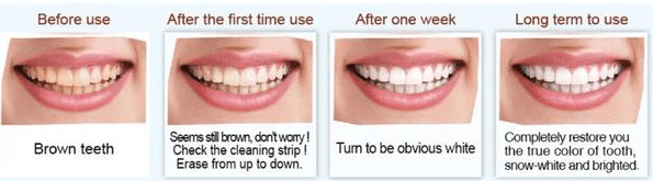 #1 Nano Teeth Whitening Kit - 10 pcs