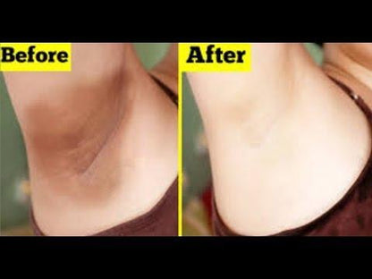 #1 Underarm Whitening Cream