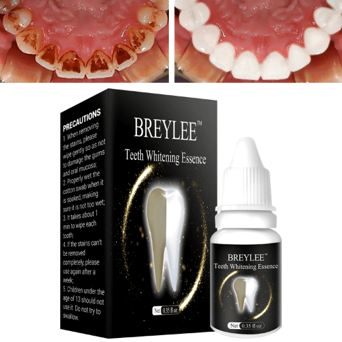 Teeth Whitening Essence - Natural Plant Extract Formula