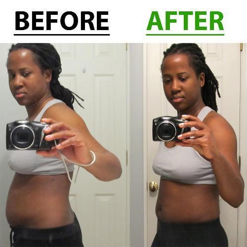 Belly Slimming Patch Set
