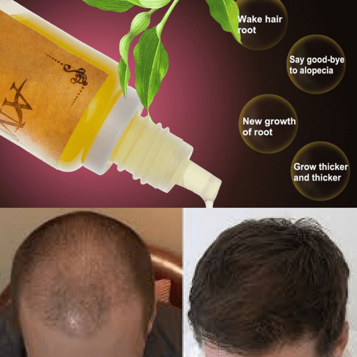 Hair Growth Stimulating Oil