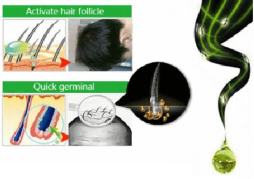 The Best Anti Hair Loss Shampoo