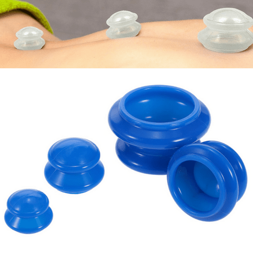 Anti Cellulite Vacuum Cupping Set - Set of 4 Cups