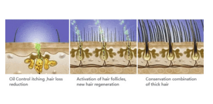 The Best Anti Hair Loss Shampoo