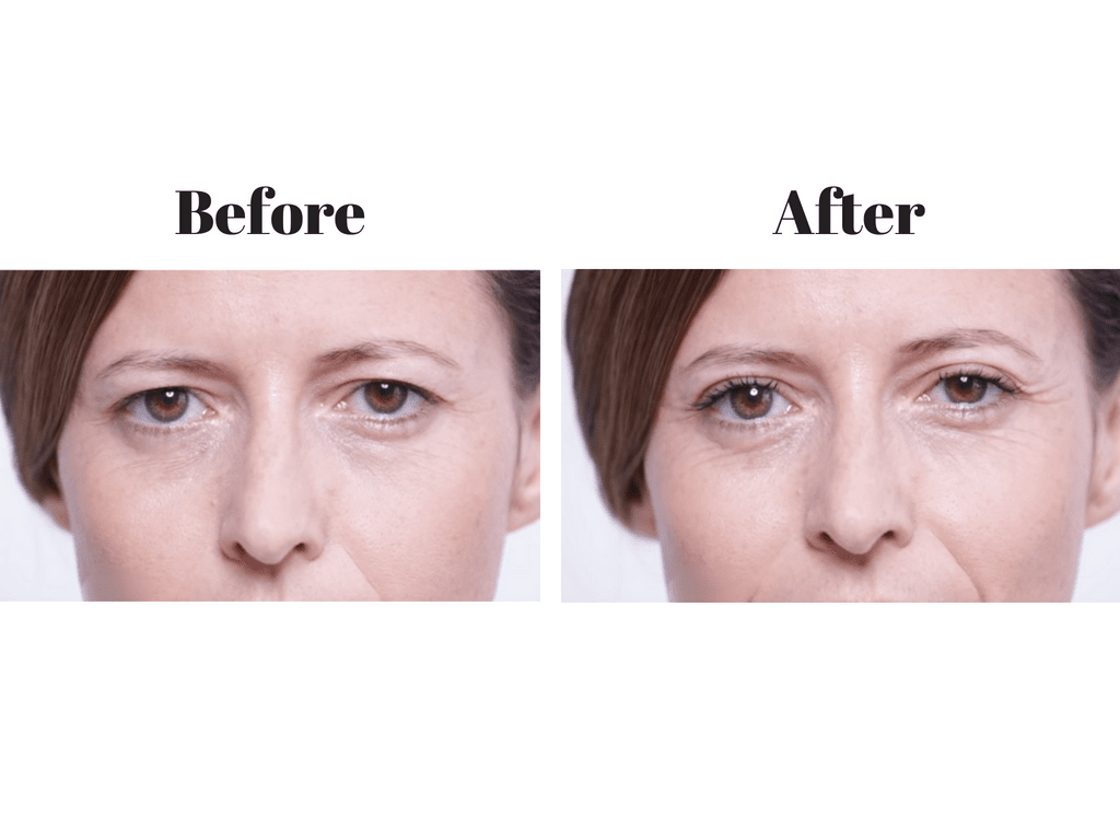 64 Pcs Instant Eye Lift Eyelid Tape