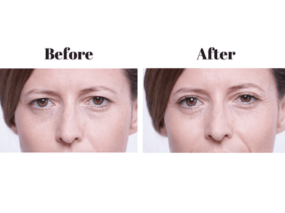 64 Pcs Instant Eye Lift Eyelid Tape