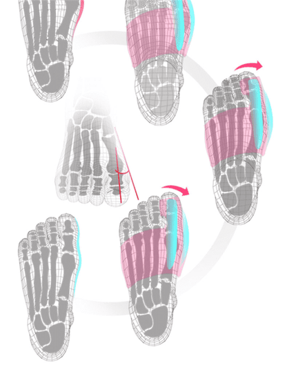 #1 Orthopedic Bunion Corrector Splints - Non-Surgical Relief & Treatment - Adjustable Pair