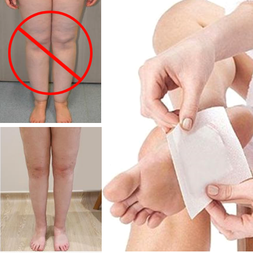 The Original Anti-Inflammation - Swelling Ginger Foot Patch - 10 Pieces