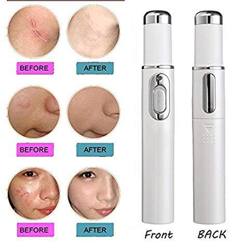 Medical Blue Light™ Therapy Laser Treatment Pen
