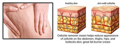 #1 Cellulite Treatment Cream - Cellulite Removal Cream