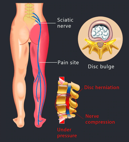 #1 Adjustable Back Stretcher - Back Pain Reliever