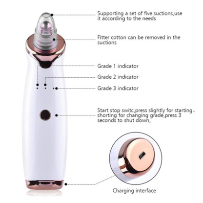 The Best Blackhead Remover