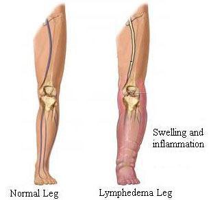 Premium Ginger Oil - Improves Swelling, Joint Pain, Infection