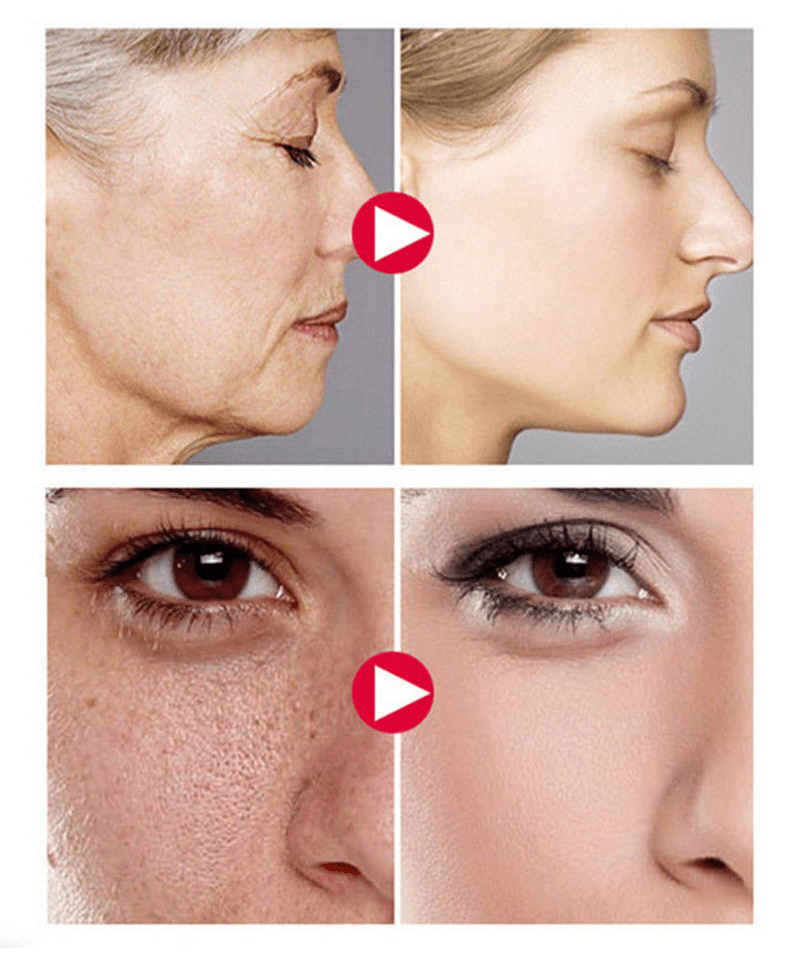 Premium Vitamin C20 Serum - Solution For Dark Spots & Age Spots