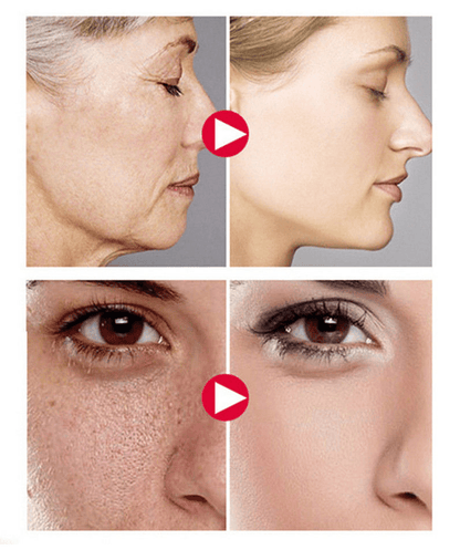 Premium Vitamin C20 Serum - Solution For Dark Spots & Age Spots
