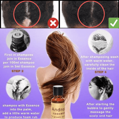 #1 Natural Hair Regrowth Solution - Effective Hair Regrowth