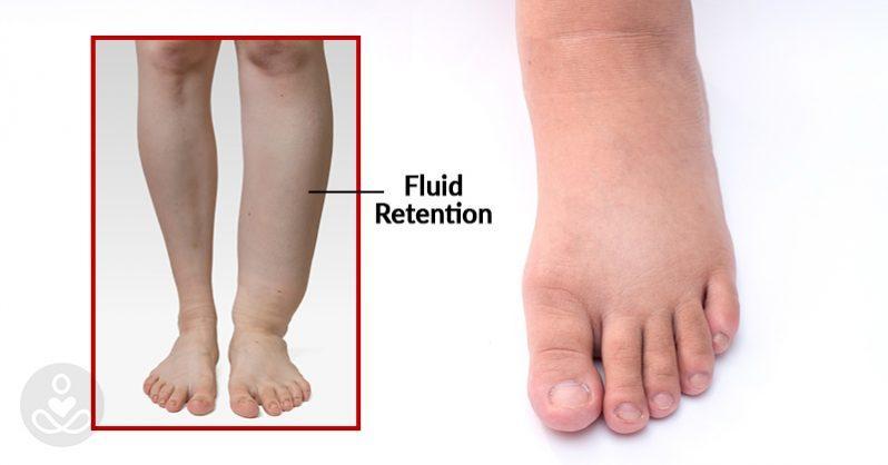 The Original Anti-Inflammation - Swelling Ginger Foot Patch - 10 Pieces