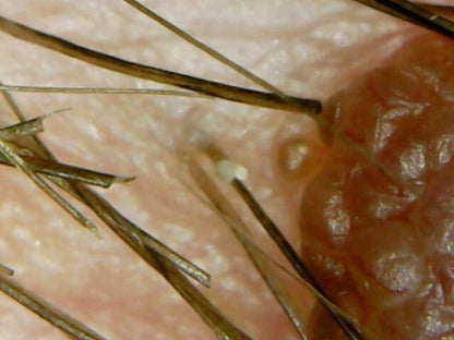 Super USB Microscope Camera - 1000X Zoom
