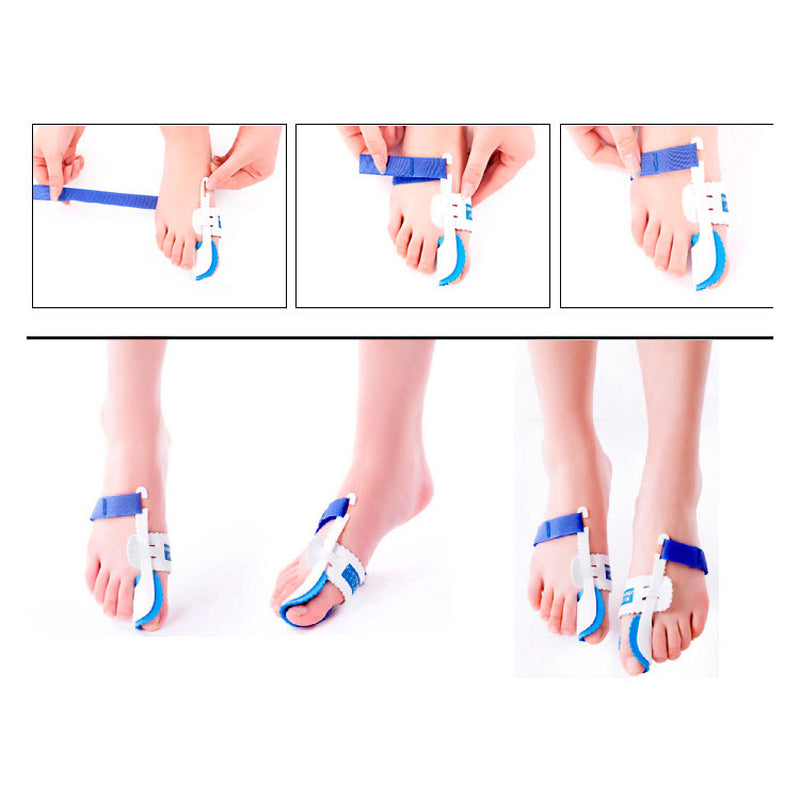 1 pair Bunion Adjuster Orthotics