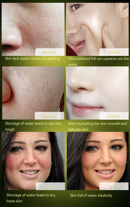 Anti Wrinkle Serum