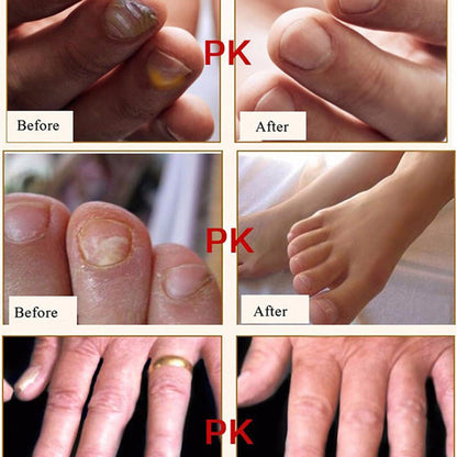 Nail Treatment Cream