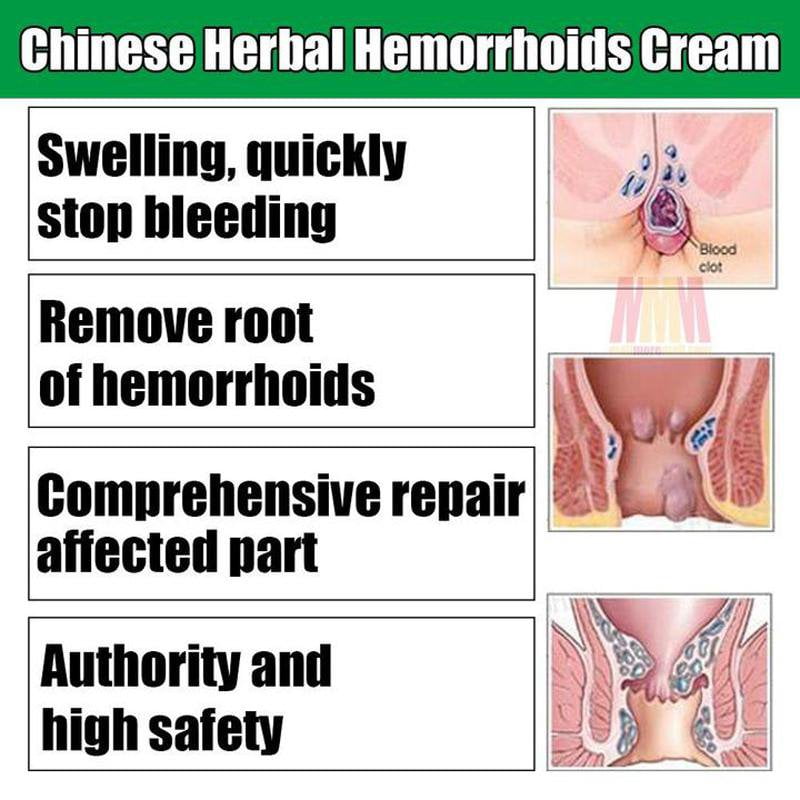 The Original #1 Herbal Hemorrhoids Treatment Cream - All Natural