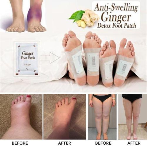 The Original Anti-Inflammation - Swelling Ginger Foot Patch - 10 Pieces