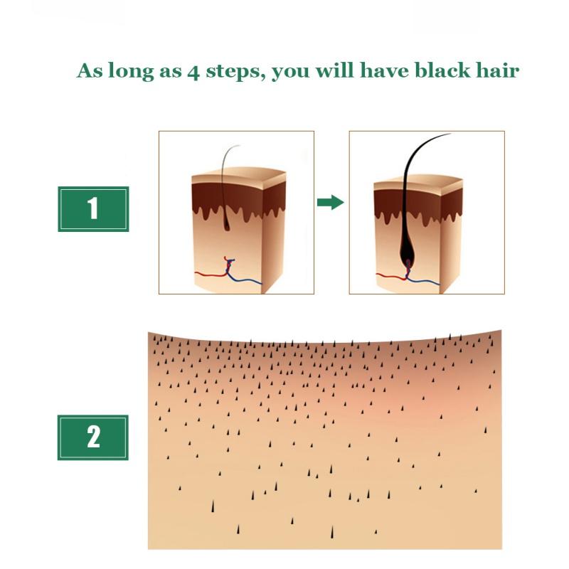 #1 Hair Regrowth Oil - Hair Regrowth Solution - All Natural