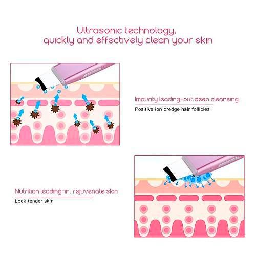 The Ultrasonic Skin Scrubber