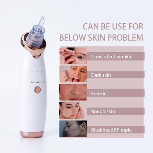 The Best Blackhead Remover