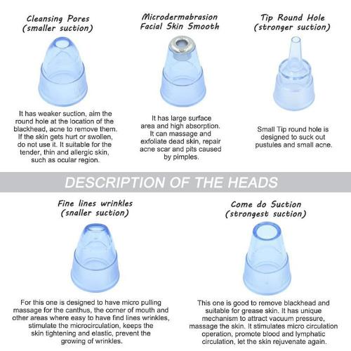 The Best Blackhead Remover