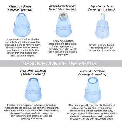 The Best Blackhead Remover