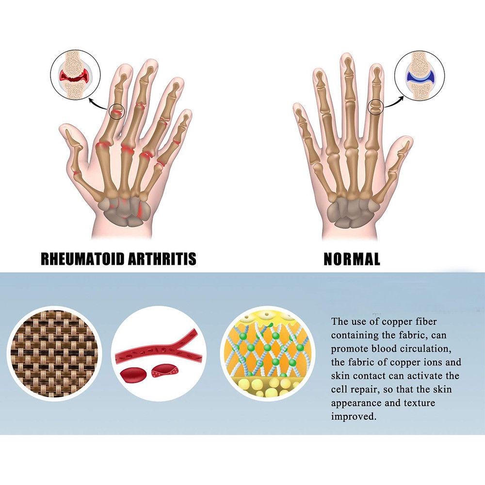 The Best Arthritis Compression Gloves