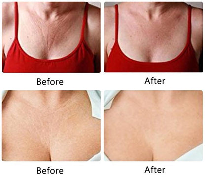 NEW Anti-Wrinkle Silicone Chest Pad