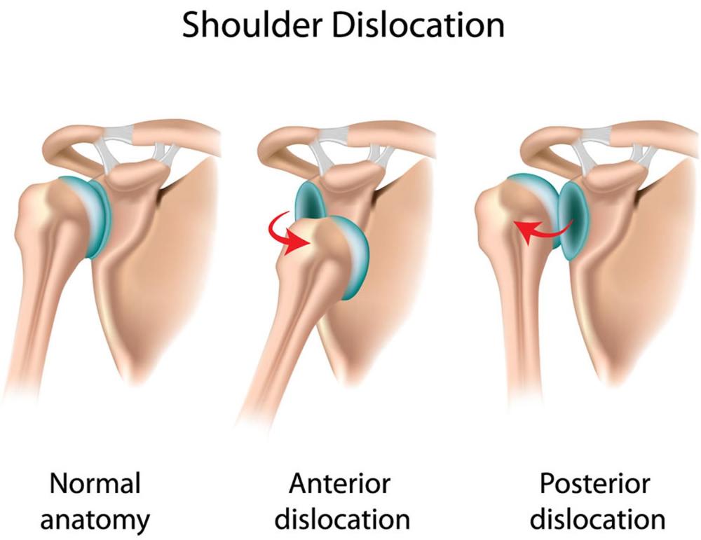 Shoulder Brace Support